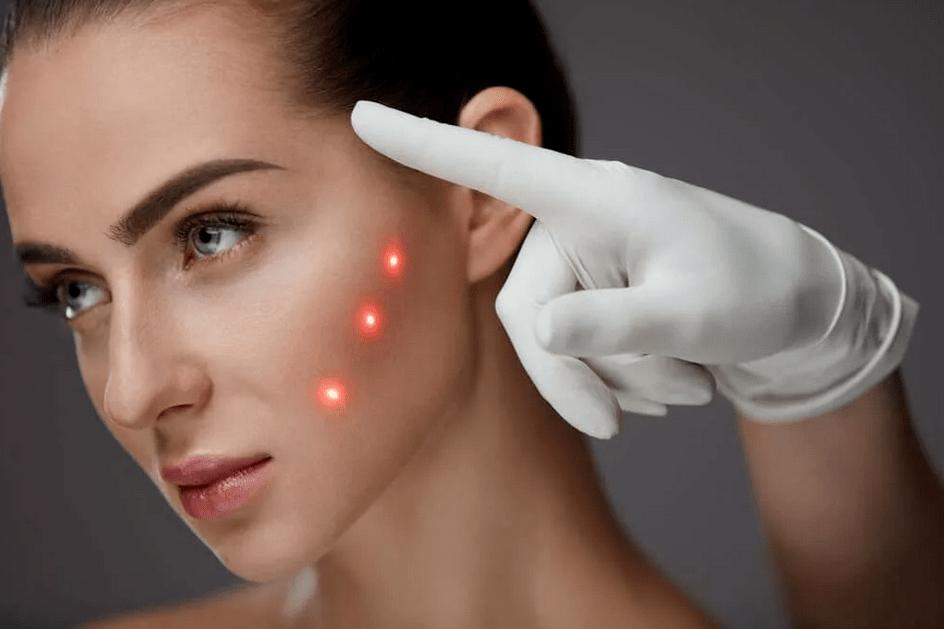 atjaunošanas metodes